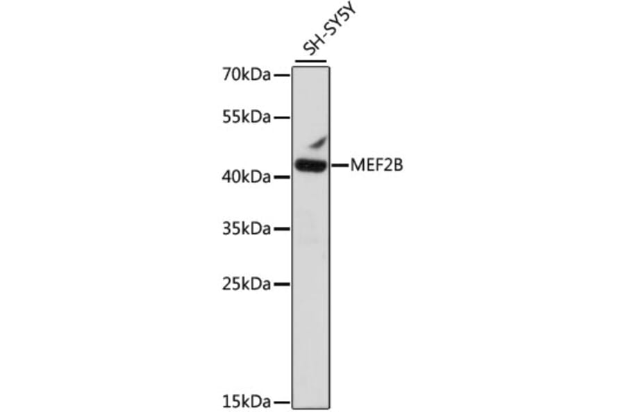 Western Blot - Anti-MEF2B Antibody (A89797) - Antibodies.com