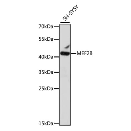 Western Blot - Anti-MEF2B Antibody (A89797) - Antibodies.com