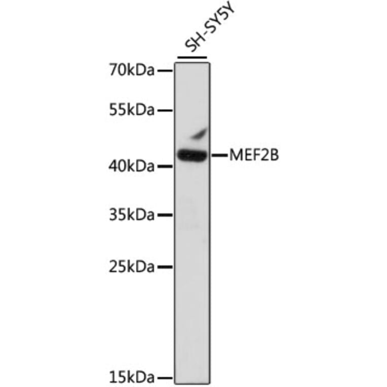 Western Blot - Anti-MEF2B Antibody (A89797) - Antibodies.com