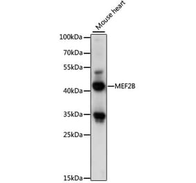 Western Blot - Anti-MEF2B Antibody (A89798) - Antibodies.com