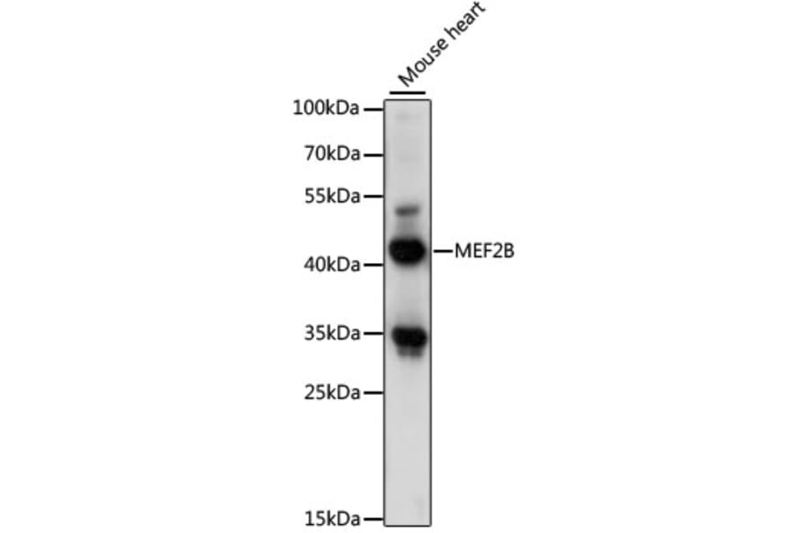 Western Blot - Anti-MEF2B Antibody (A89798) - Antibodies.com