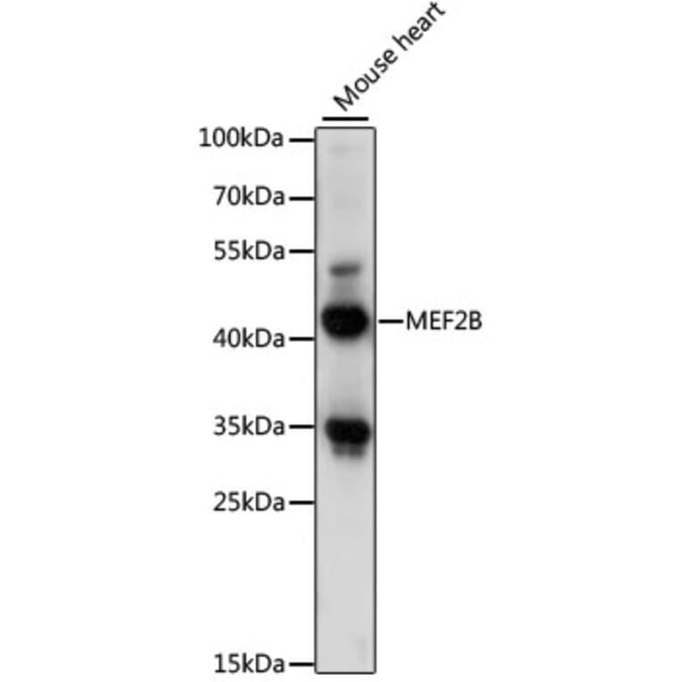 Western Blot - Anti-MEF2B Antibody (A89798) - Antibodies.com