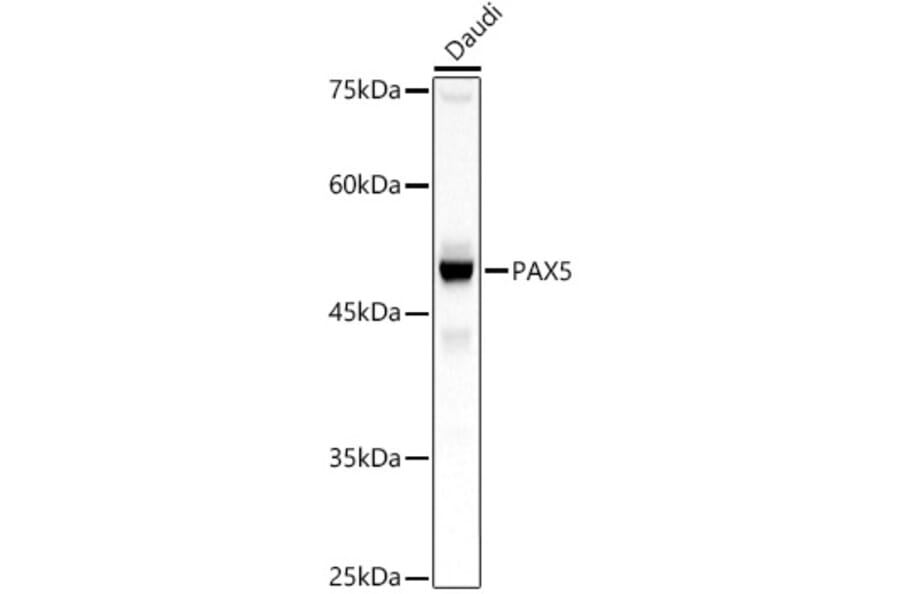 Western Blot - Anti-PAX5 Antibody (A89799) - Antibodies.com