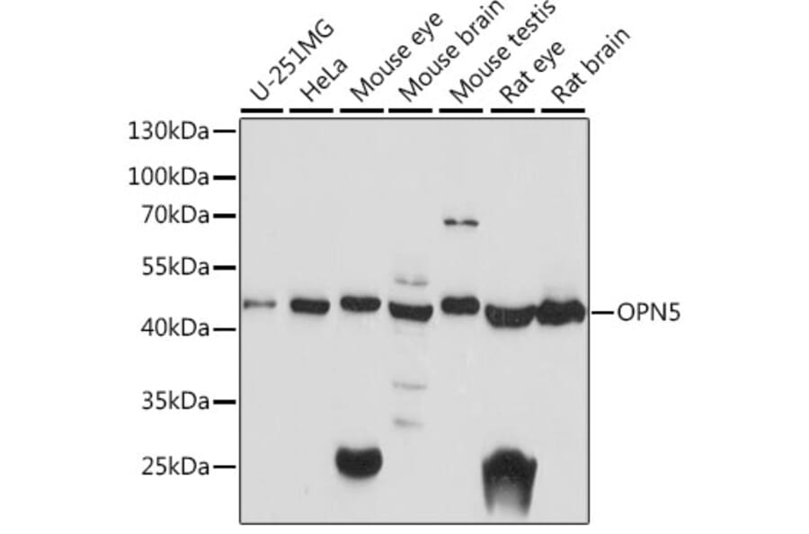 Western Blot - Anti-OPN5 Antibody (A89801) - Antibodies.com