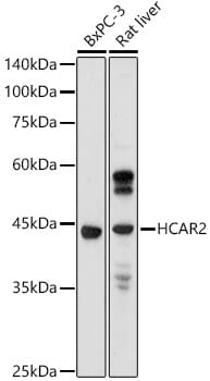 Western blot analysis of extracts of various cell lines, using Anti-HCAR2 Antibody (A15611) at 1:1,000 dilution.
Secondary antibody: Goat Anti-Rabbit IgG (H+L) (HRP) (AS014) at 1:10,000 dilution.
Lysates / proteins: 25µg per lane.
Blocking buffer: 3% non-fat dry milk in TBST.
Detection: ECL Basic Kit (RM00020).
Exposure time: 60s.