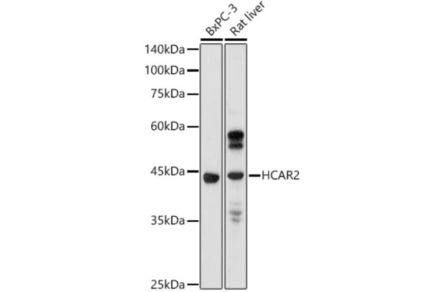Western Blot - Anti-Puma gamma / GPR109A Antibody (A89802) - Antibodies.com