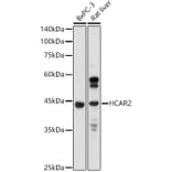 Western Blot - Anti-Puma gamma / GPR109A Antibody (A89802) - Antibodies.com