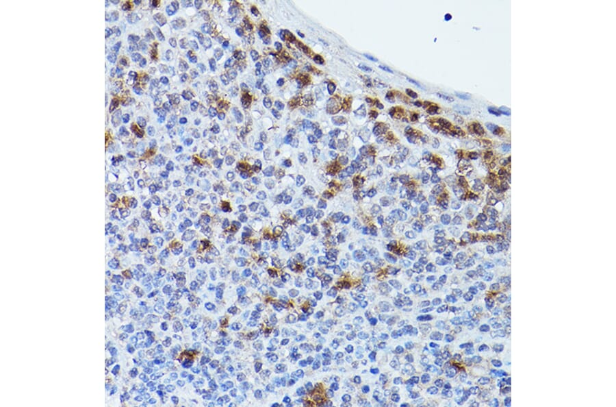 Immunohistochemistry - Anti-Puma gamma / GPR109A Antibody (A89802) - Antibodies.com