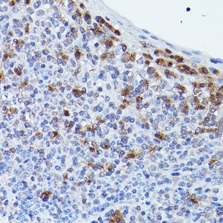 Immunohistochemistry - Anti-Puma gamma / GPR109A Antibody (A89802) - Antibodies.com