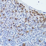Immunohistochemistry - Anti-Puma gamma / GPR109A Antibody (A89802) - Antibodies.com