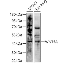 Western Blot - Anti-Wnt5a Antibody (A89803) - Antibodies.com