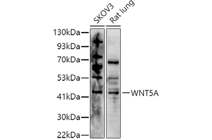 Western Blot - Anti-Wnt5a Antibody (A89803) - Antibodies.com