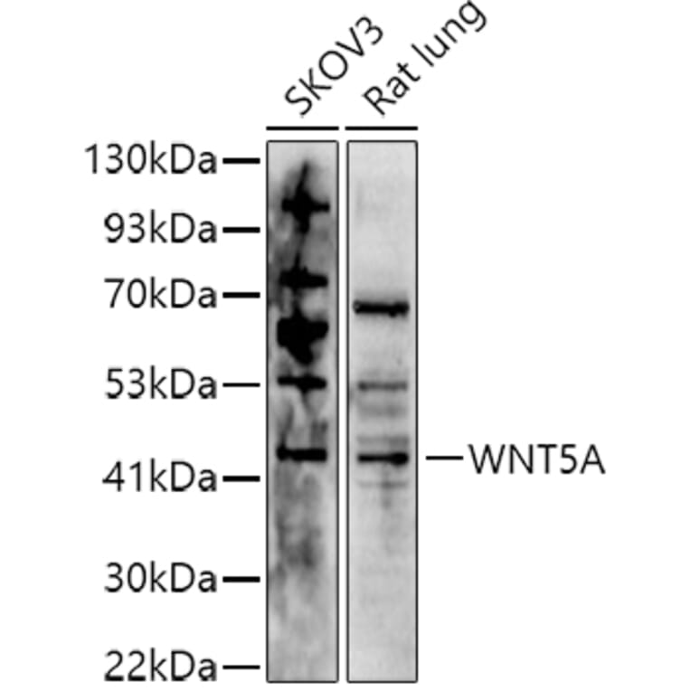 Western Blot - Anti-Wnt5a Antibody (A89803) - Antibodies.com