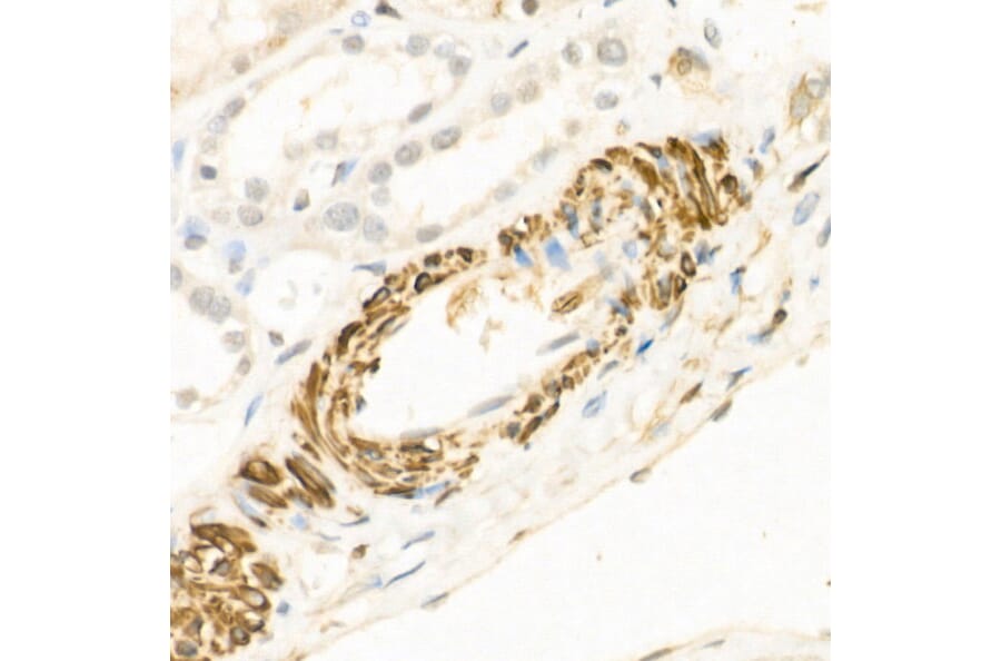 Immunohistochemistry - Anti-Wnt5a Antibody (A89803) - Antibodies.com