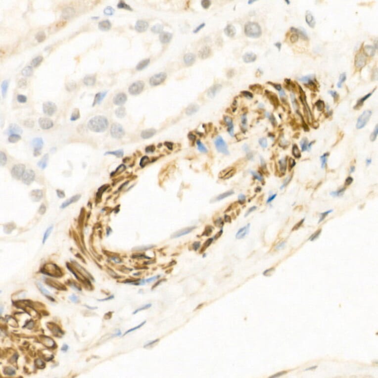 Immunohistochemistry - Anti-Wnt5a Antibody (A89803) - Antibodies.com