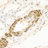 Immunohistochemistry - Anti-Wnt5a Antibody (A89803) - Antibodies.com