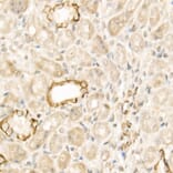 Immunohistochemistry - Anti-Wnt5a Antibody (A89803) - Antibodies.com