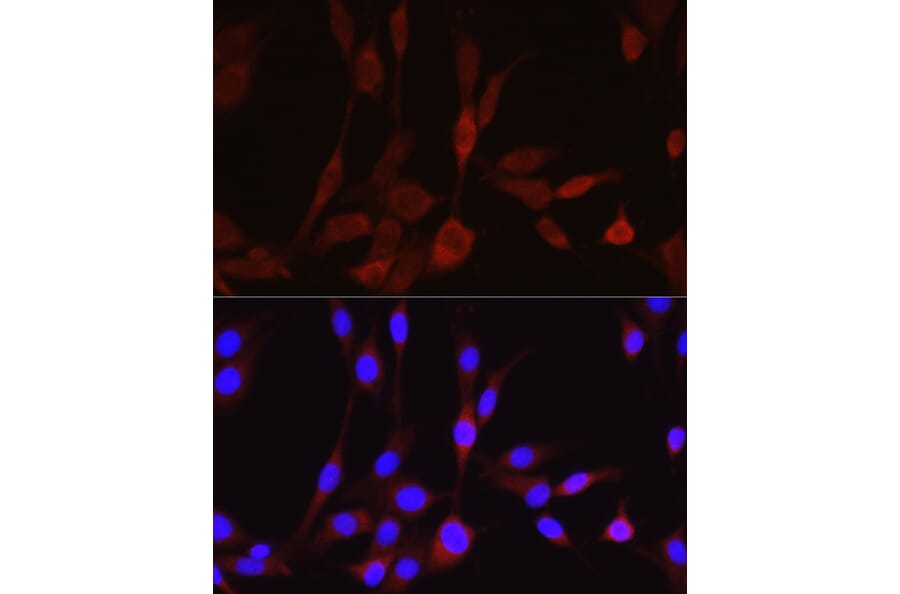 Immunofluorescence - Anti-Wnt5a Antibody (A89803) - Antibodies.com