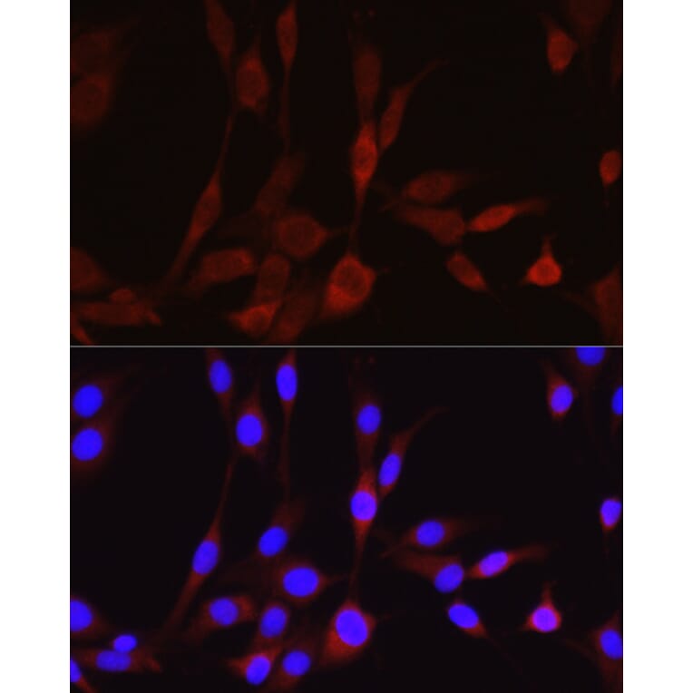 Immunofluorescence - Anti-Wnt5a Antibody (A89803) - Antibodies.com