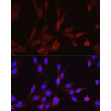 Immunofluorescence - Anti-Wnt5a Antibody (A89803) - Antibodies.com