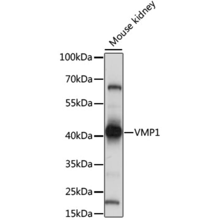 Western Blot - Anti-TMEM49/VMP1 Antibody (A89804) - Antibodies.com