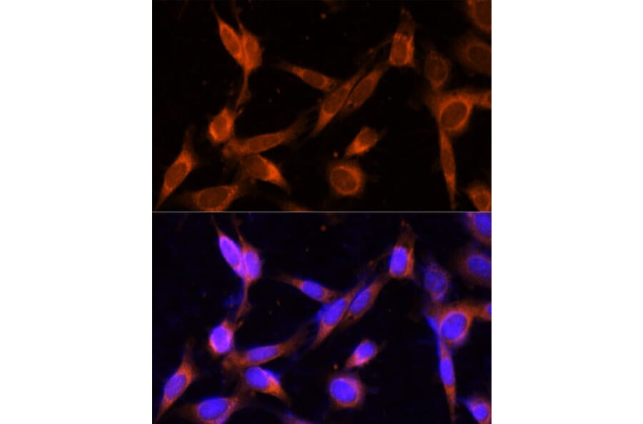 Immunofluorescence - Anti-TMEM49/VMP1 Antibody (A89804) - Antibodies.com