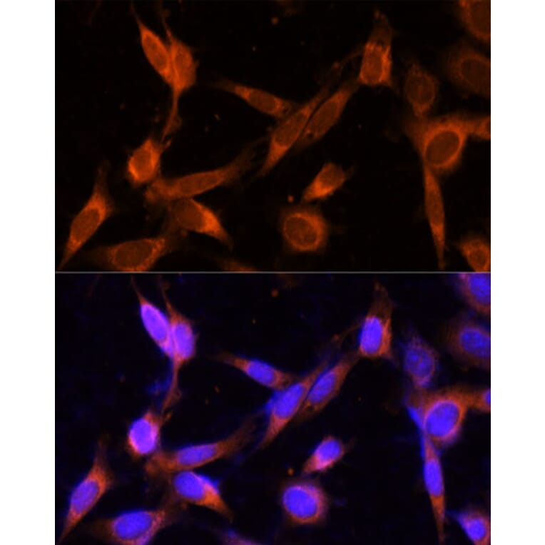 Immunofluorescence - Anti-TMEM49/VMP1 Antibody (A89804) - Antibodies.com