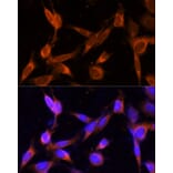 Immunofluorescence - Anti-TMEM49/VMP1 Antibody (A89804) - Antibodies.com