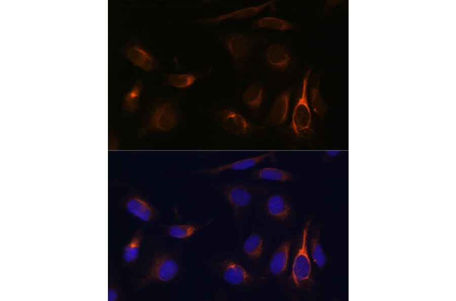 Immunofluorescence - Anti-TMEM49/VMP1 Antibody (A89804) - Antibodies.com