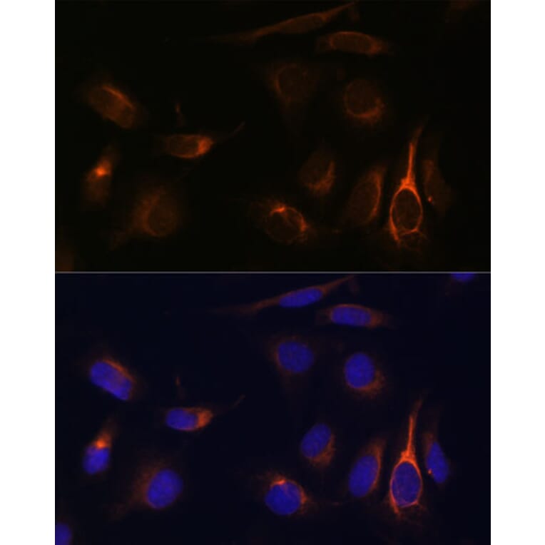 Immunofluorescence - Anti-TMEM49/VMP1 Antibody (A89804) - Antibodies.com