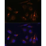 Immunofluorescence - Anti-TMEM49/VMP1 Antibody (A89804) - Antibodies.com