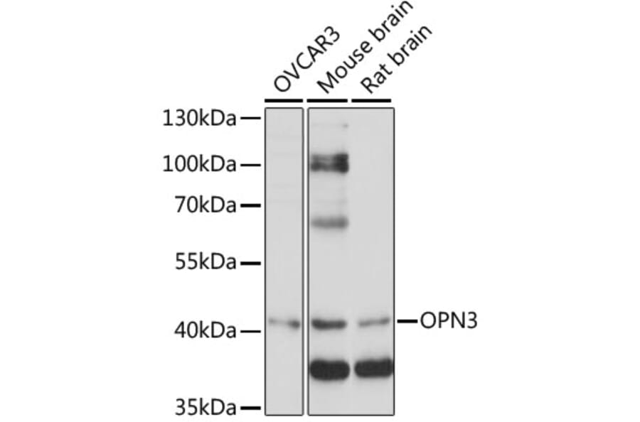 Western Blot - Anti-OPN3 Antibody (A89805) - Antibodies.com