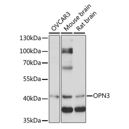 Western Blot - Anti-OPN3 Antibody (A89805) - Antibodies.com