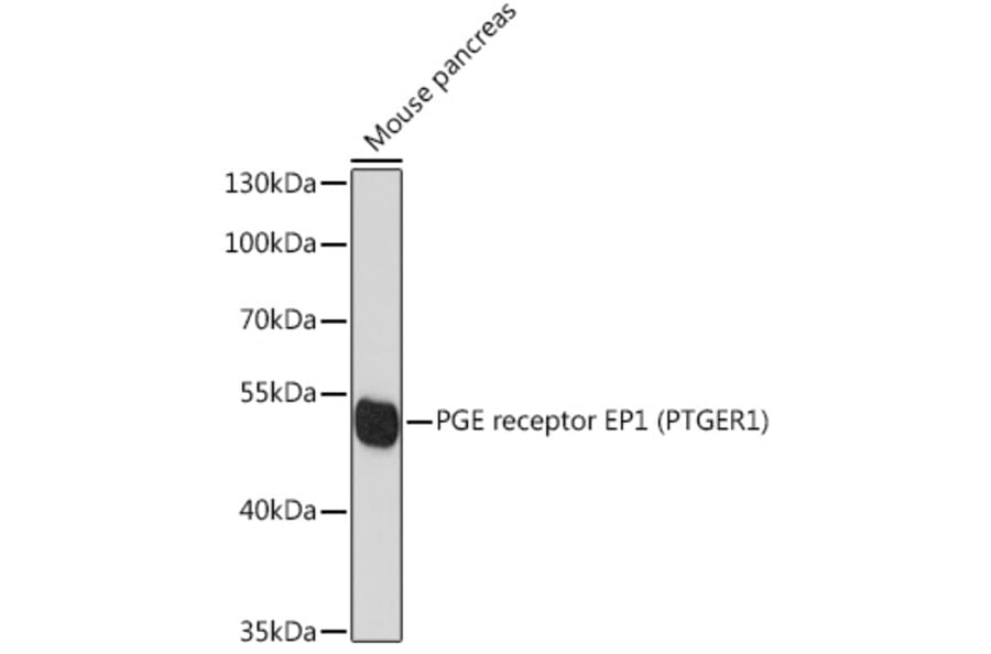 Western Blot - Anti-Prostaglandin E Receptor EP1/PTGER1 Antibody (A89806) - Antibodies.com