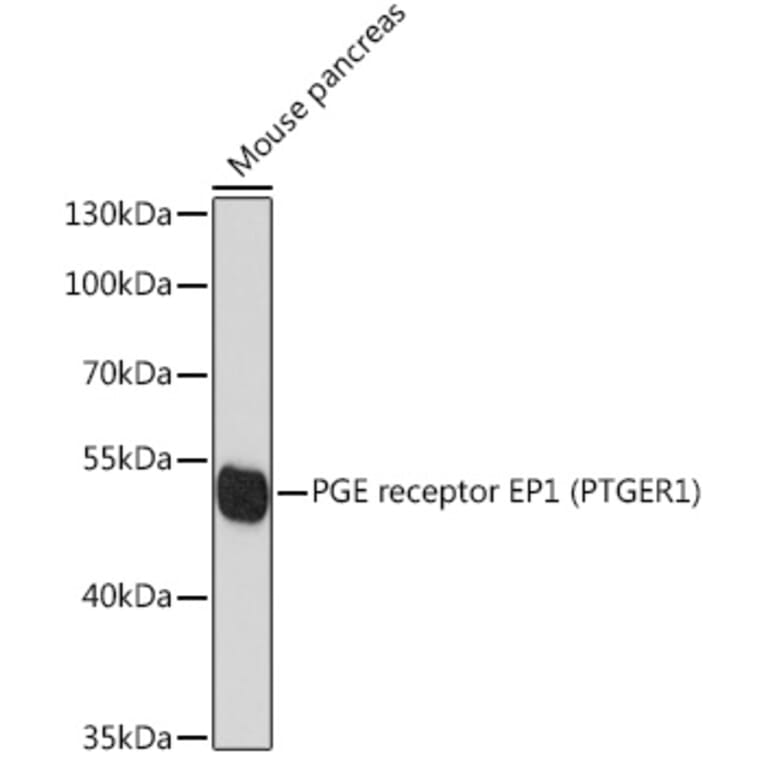 Western Blot - Anti-Prostaglandin E Receptor EP1/PTGER1 Antibody (A89806) - Antibodies.com