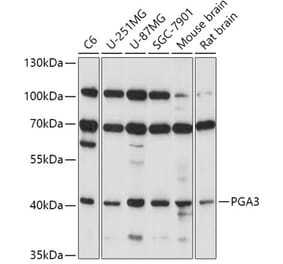 Western Blot - Anti-PGA3 Antibody (A89807) - Antibodies.com