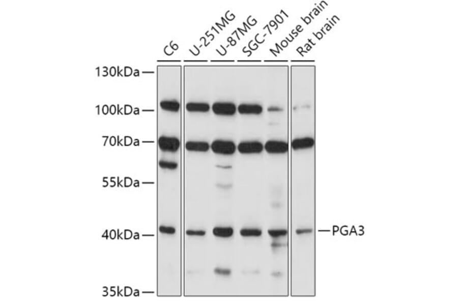 Western Blot - Anti-PGA3 Antibody (A89807) - Antibodies.com