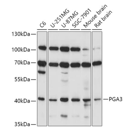 Western Blot - Anti-PGA3 Antibody (A89807) - Antibodies.com