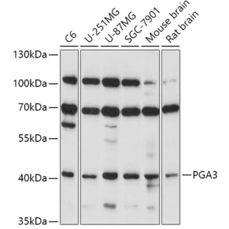 Western Blot - Anti-PGA3 Antibody (A89807) - Antibodies.com