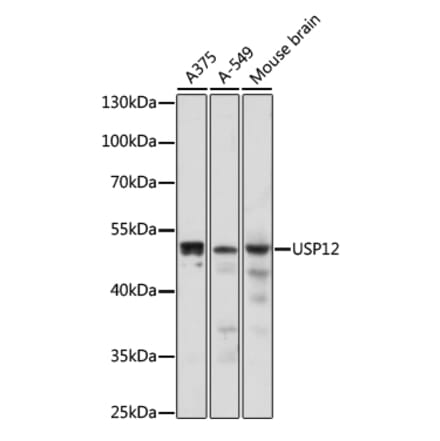 Western Blot - Anti-USP12 Antibody (A89808) - Antibodies.com