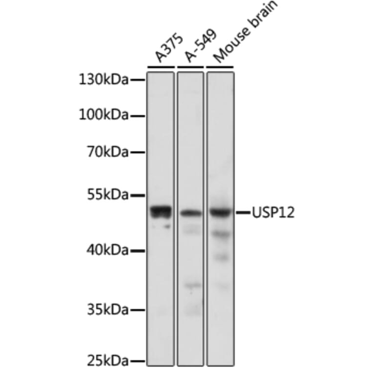 Western Blot - Anti-USP12 Antibody (A89808) - Antibodies.com