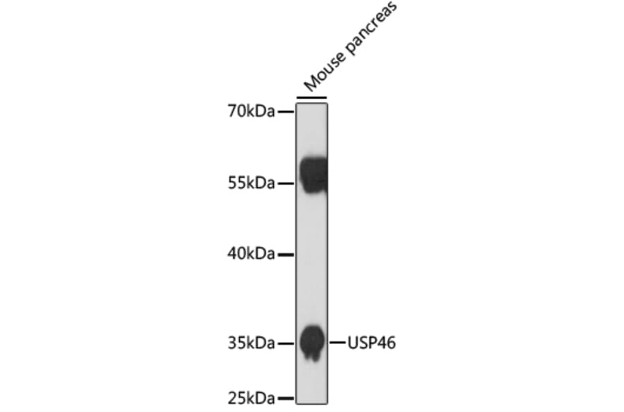 Western Blot - Anti-USP46 Antibody (A89809) - Antibodies.com