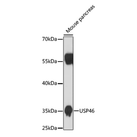 Western Blot - Anti-USP46 Antibody (A89809) - Antibodies.com