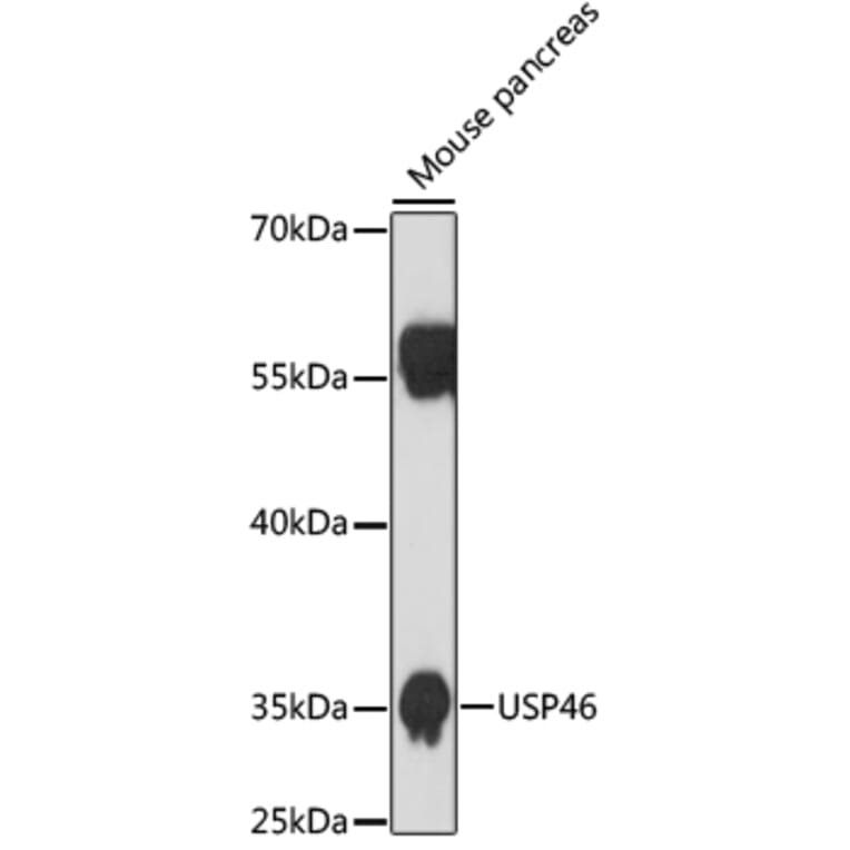 Western Blot - Anti-USP46 Antibody (A89809) - Antibodies.com