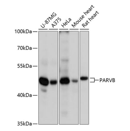 Western Blot - Anti-PARVB Antibody (A89810) - Antibodies.com