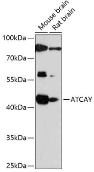 Western blot analysis of extracts of various cell lines, using Anti-ATCAY Antibody (A14947) at 1:1,000 dilution.
Secondary antibody: Goat Anti-Rabbit IgG (H+L) (HRP) (AS014) at 1:10,000 dilution.
Lysates / proteins: 25µg per lane.
Blocking buffer: 3% non-fat dry milk in TBST.
Detection: ECL Basic Kit (RM00020).
Exposure time: 90s.