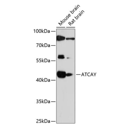 Western Blot - Anti-ATCAY Antibody (A89811) - Antibodies.com
