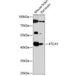 Western Blot - Anti-ATCAY Antibody (A89811) - Antibodies.com