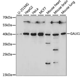 Western Blot - Anti-GALK1 Antibody (A89812) - Antibodies.com