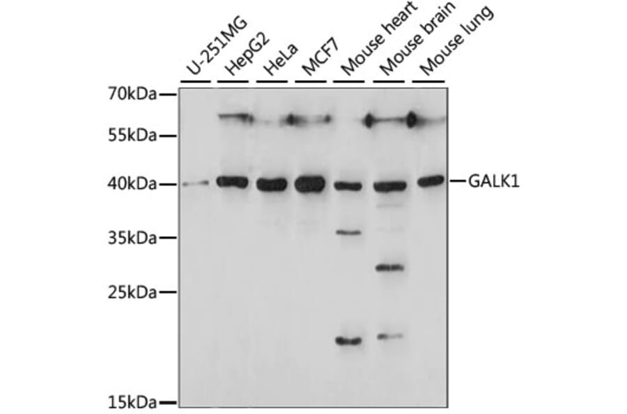 Western Blot - Anti-GALK1 Antibody (A89812) - Antibodies.com